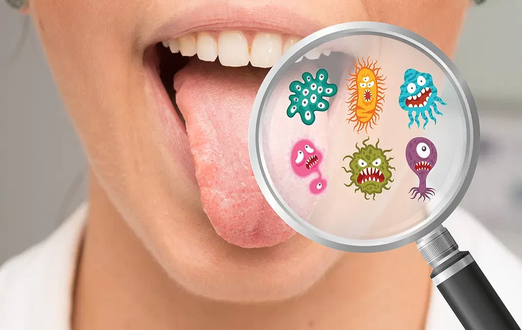 Oral Bacteria Can Cause Brain Abscesses
