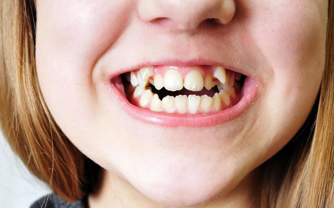orthodontists straighten your crooked teeth