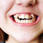 orthodontists straighten your crooked teeth