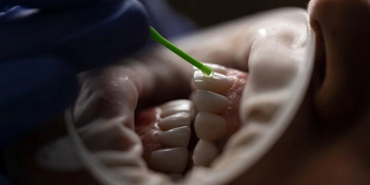 tooth enamel regeneration