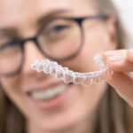 Clear Aligners