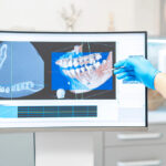 Personalized dental implants
