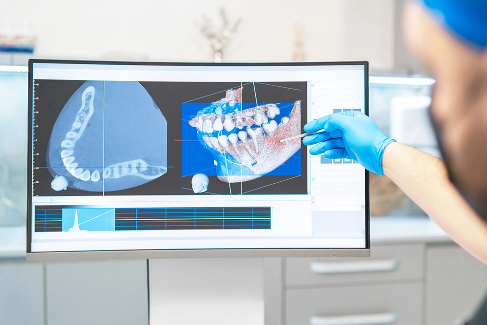 The Rise of Personalized Dental Implants with Digital Design
